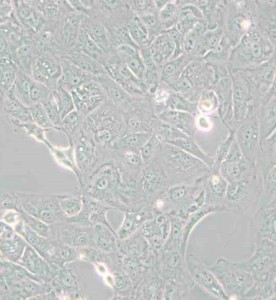 769-P人腎細胞腺癌細胞主圖