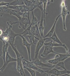 A172人膠質(zhì)母細胞瘤細胞主圖