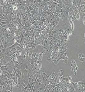 HCT-15人結直腸腺癌細胞主圖