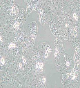 HEC-1-A人子宮內膜腺癌細胞主圖