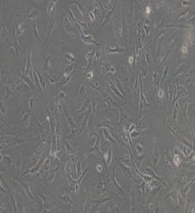 HULEC-5a人肺微血管內(nèi)皮細(xì)胞主圖