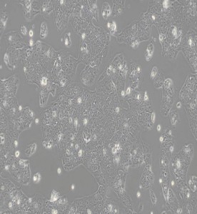 JEG-3人絨毛膜癌細胞主圖