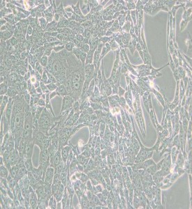 RENCA小鼠腎癌細(xì)胞主圖