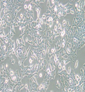 P19小鼠畸胎瘤細(xì)胞主圖