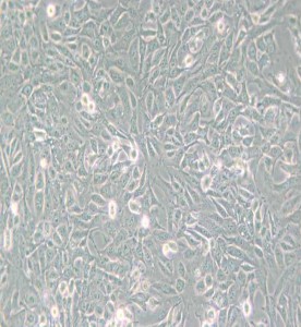 SV40 MES 13小鼠腎小球系膜細胞主圖