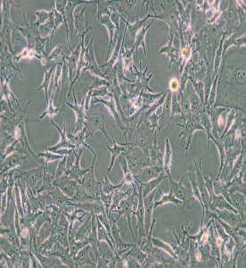 B16-F0小鼠黑色素瘤細(xì)胞主圖