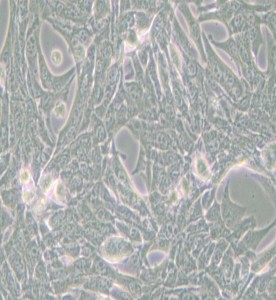 Panc02小鼠胰腺癌細(xì)胞主圖