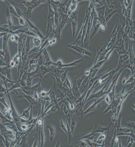 NCI-H1975人肺腺癌細(xì)胞主圖
