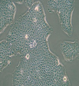 RT4人膀胱移行細胞乳頭瘤細胞主圖