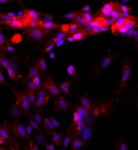 大鼠肝竇內(nèi)皮細(xì)胞主圖