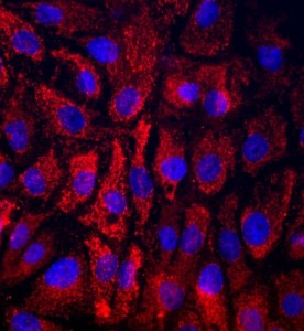 大鼠子宮頸上皮細胞主圖