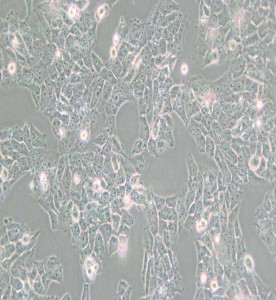 SK-N-AS人神經母細胞瘤細胞主圖