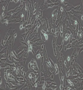 SK-N-SH人神經(jīng)母細(xì)胞瘤細(xì)胞主圖