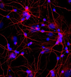 大鼠皮層神經(jīng)元細(xì)胞主圖