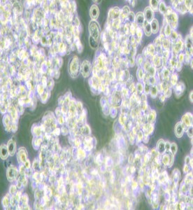 NCI-H524人小細胞肺癌細胞主圖