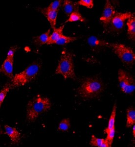 大鼠椎間盤髓核細胞主圖