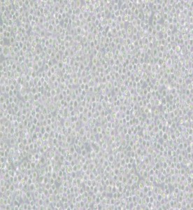 Ramos [RA 1]人B淋巴細(xì)胞瘤細(xì)胞主圖