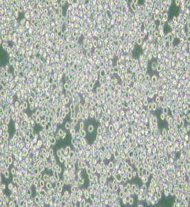 RPMI 8226人多發(fā)性骨髓瘤外周血B淋巴細(xì)胞主圖