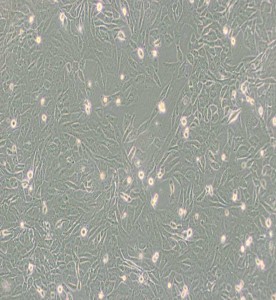 SW872人脂肪肉瘤細胞(DMEM)主圖