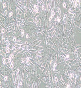 UM-UC-3人膀胱移行細胞癌主圖