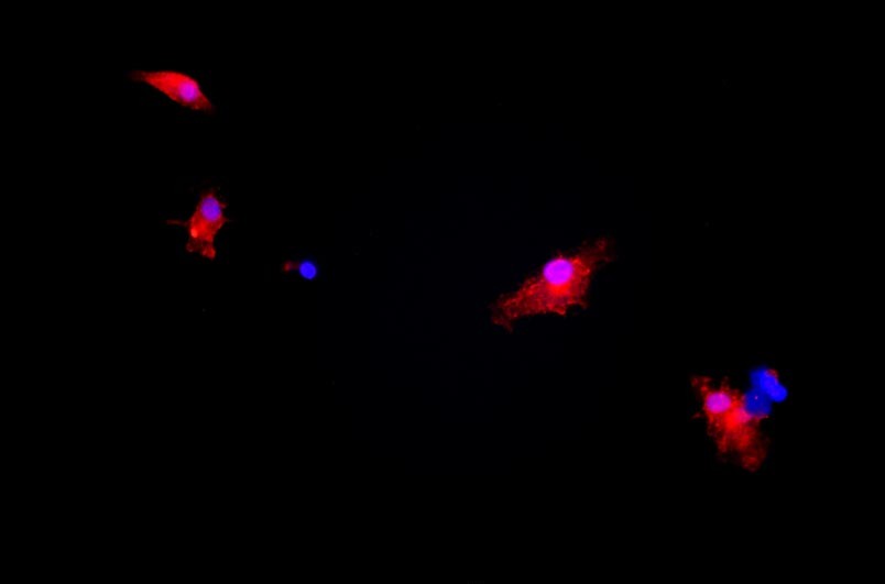 小鼠神經(jīng)小膠質(zhì)細(xì)胞主圖
