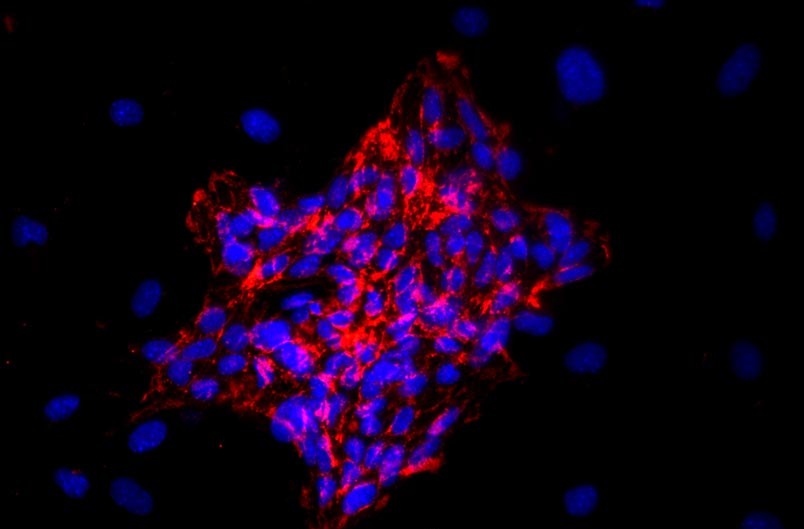 小鼠心臟微血管內皮細胞主圖