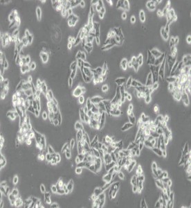 CW-2人結腸腺癌細胞主圖