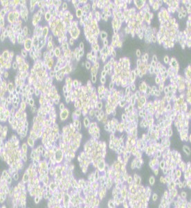 EB-3人Burkitt's淋巴瘤細(xì)胞主圖