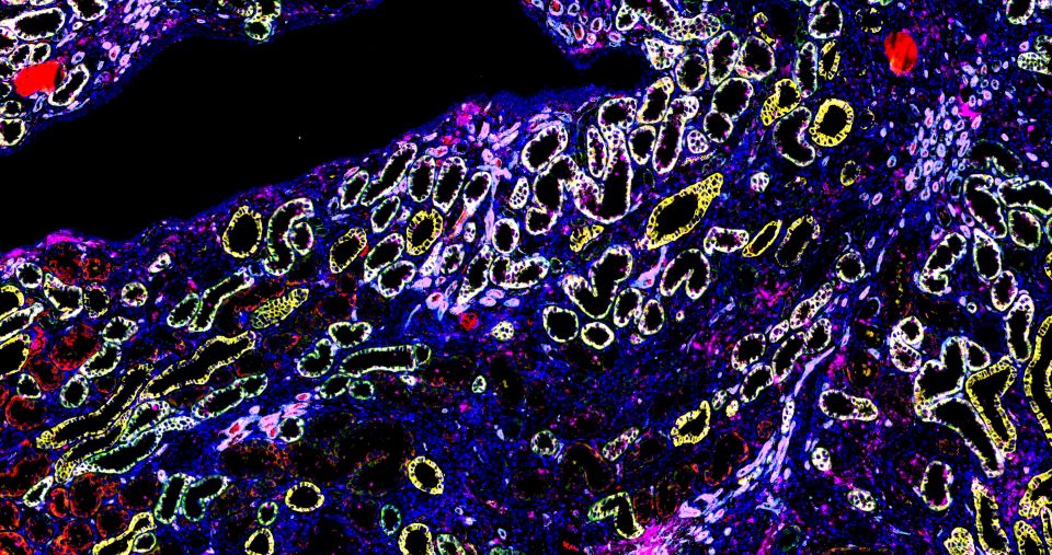 免疫熒光五標(biāo)六色染色主圖
