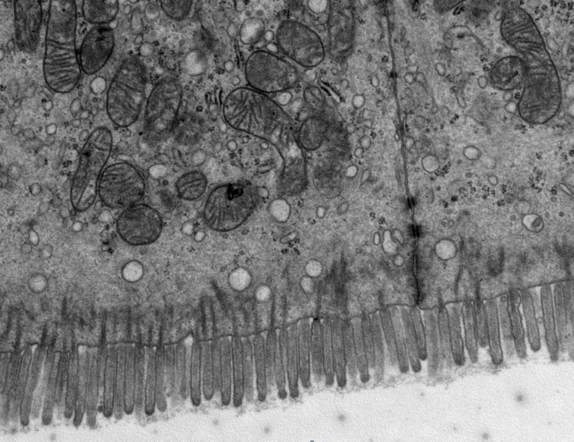 TEM透射電鏡全套主圖