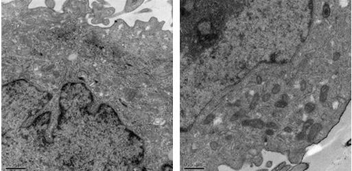 透射電鏡下細胞結構